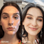 before and after of women who cleared up her acne using The Acne Lab skincare and support.