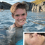 teen boy with acne got clear skin with acne treatments