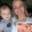 Woman who cleared her acne by avoiding pore cloggers